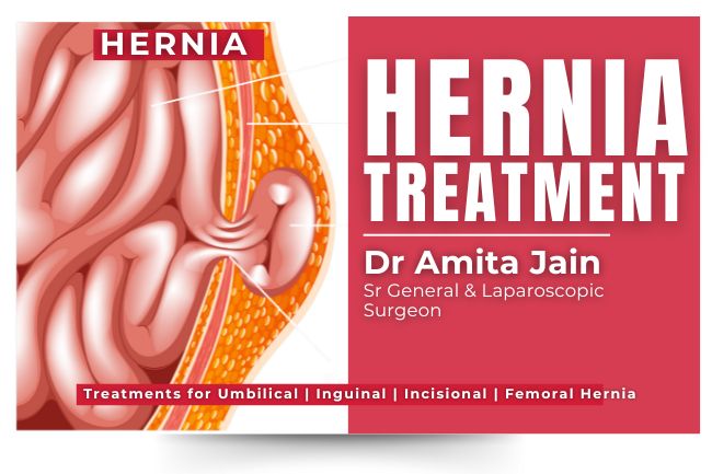 Dr Amita Jain top hernia surgeon in Delhi Dr Amita Jain best surgeon for hernia treatment